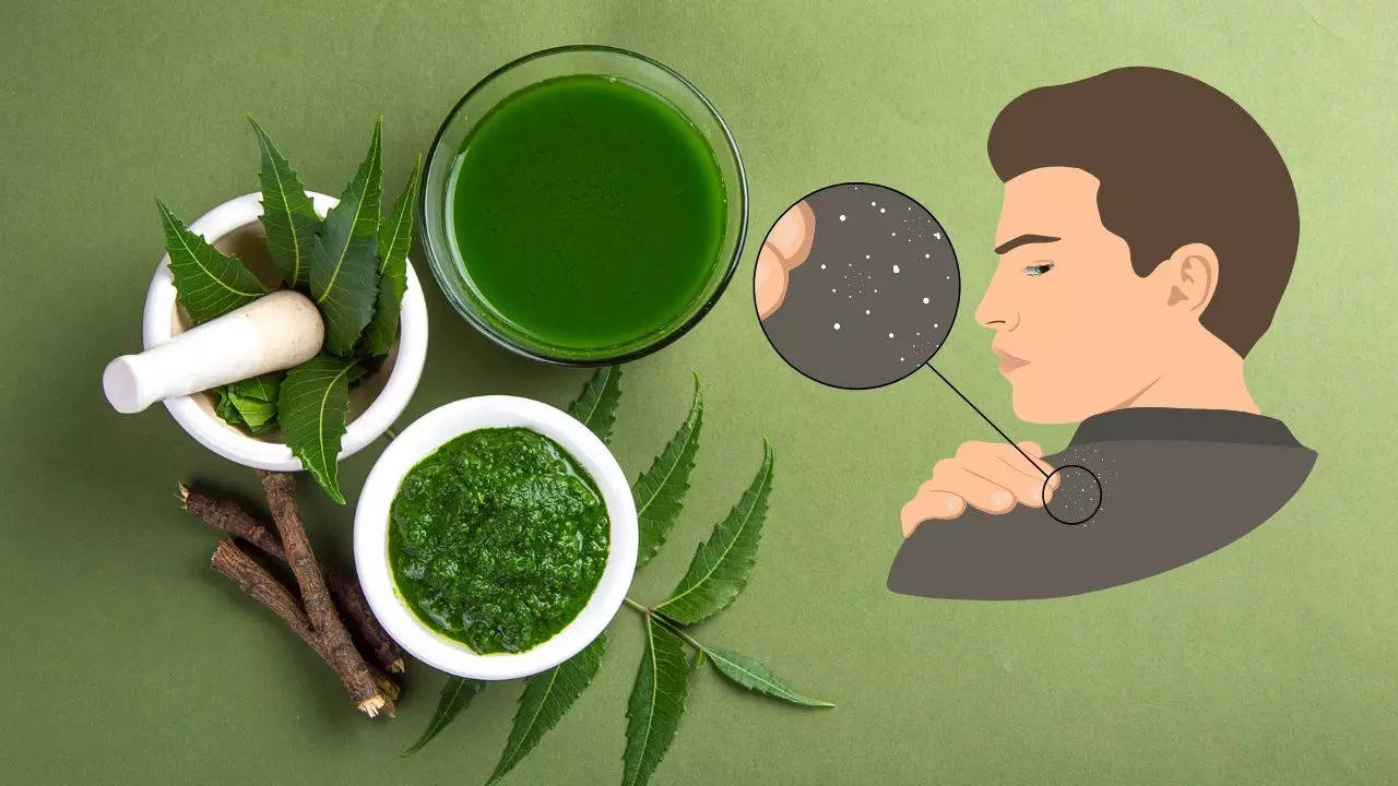 Neem for Dandruff