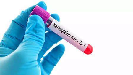 hemoglobin levels Include these nutrients in your diet for hemoglobin naturally-Hemoglobin : अपने आहार में लें ये पोषक तत्व, शरीर में कभी नहीं होगी हीमोग्लोबिन की कमी | हेल्थ News, Times Now