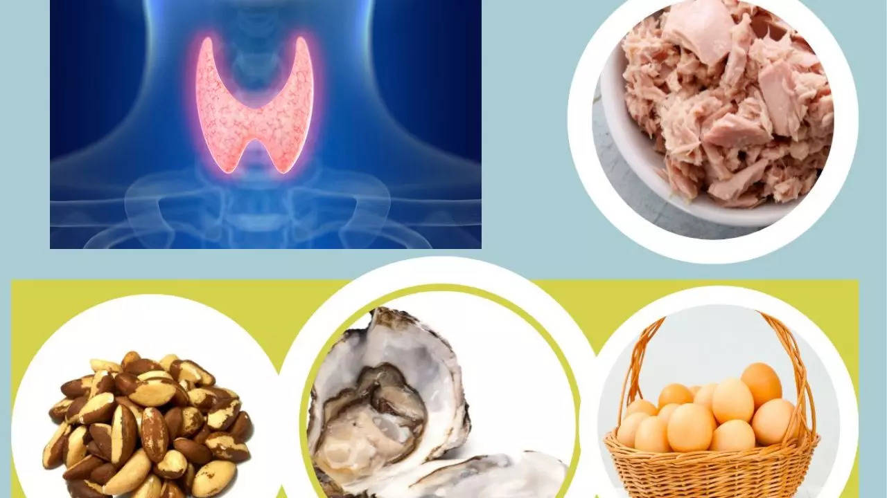 Diet of hypothyroidism patients