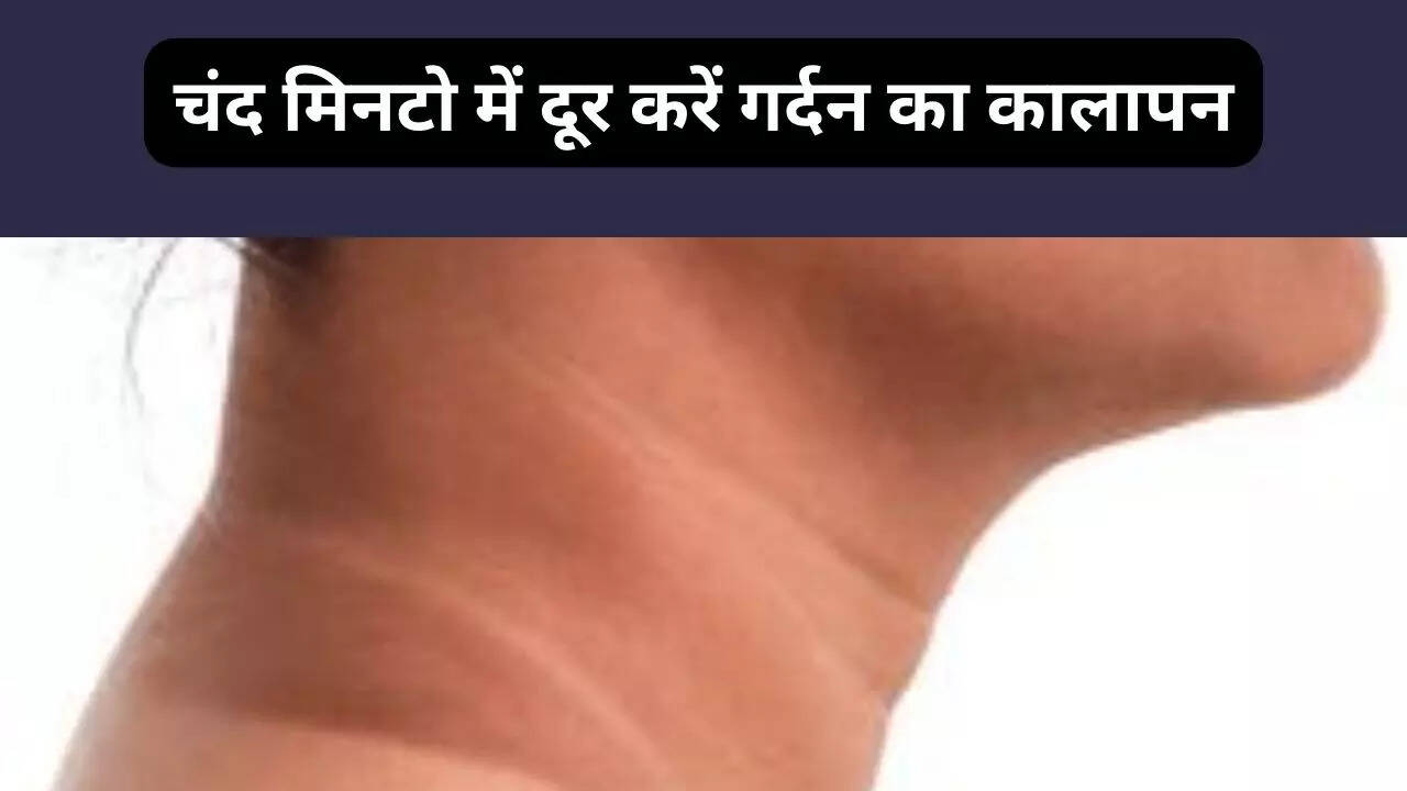 How get rid dark Neck Overnight In 20 Minutes, Home Remedies For Dark