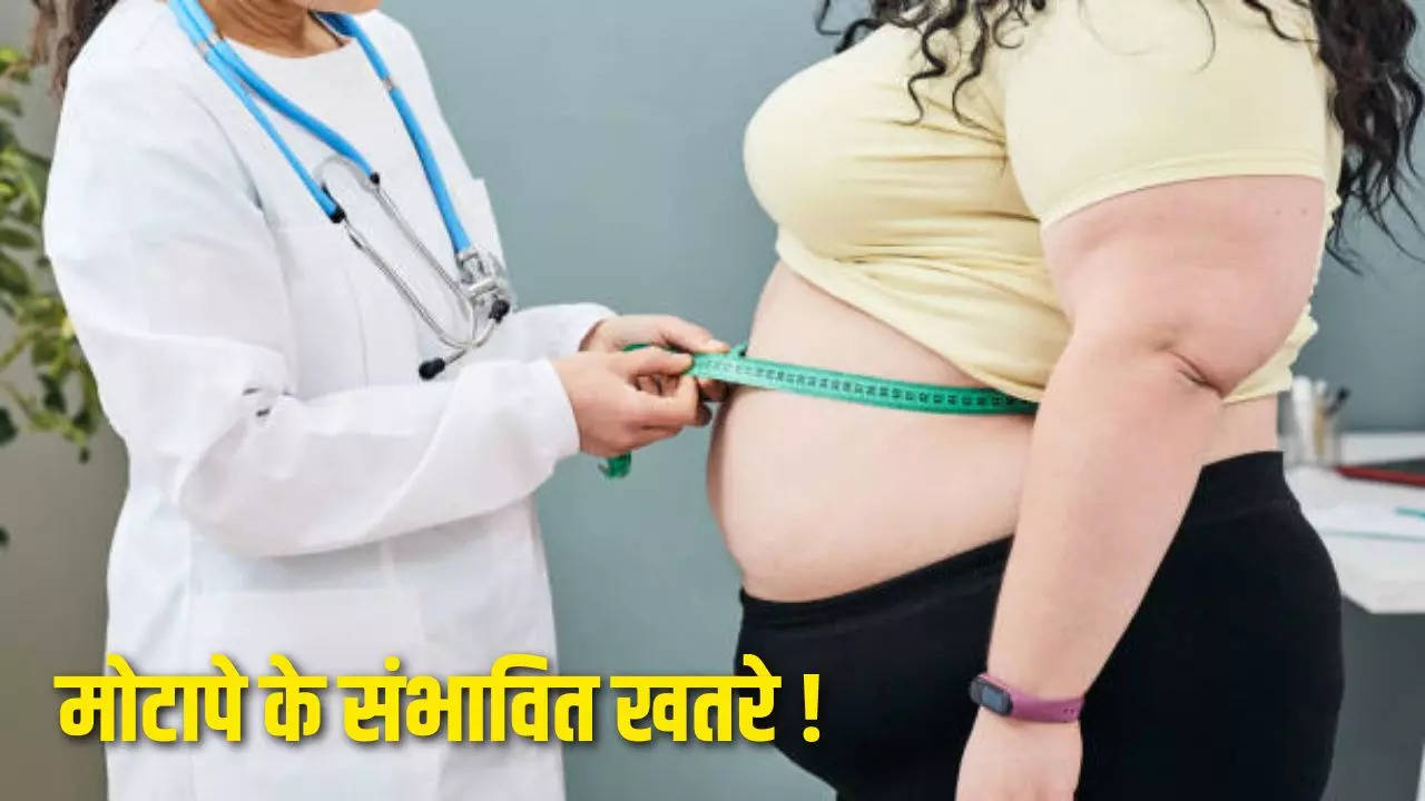 Obesity, Obesity Causes, Weight Loss Tips