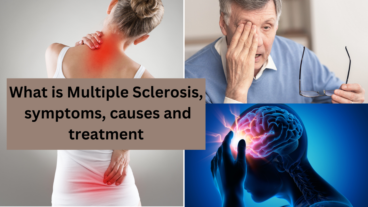 Multiple sclerosis, Multiple sclerosis symptoms, Multiple sclerosis causes and treatment  (3)